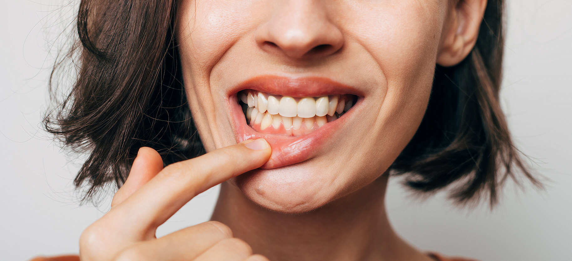 Важность иммунитета полости рта для здоровья зубов и десен: Изображение 1